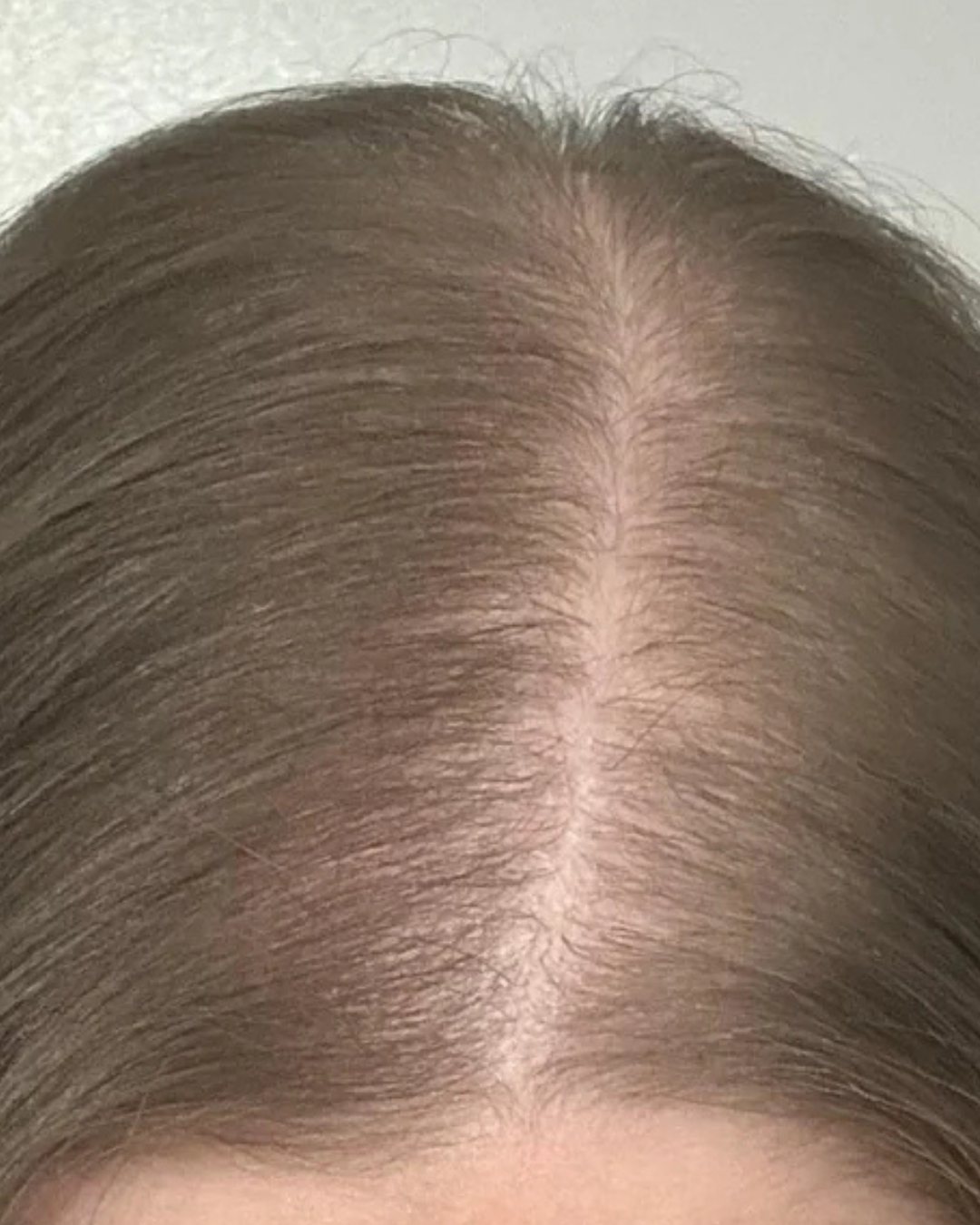 After 1 month
